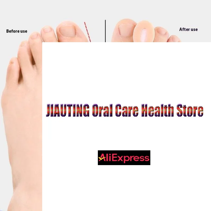 1pairs فاصل أصابع القدم الورم مصحح جل تو فاصل تو حامي الإغاثة الألم من الورم متداخلة وإصبع القدم المنجرف #2