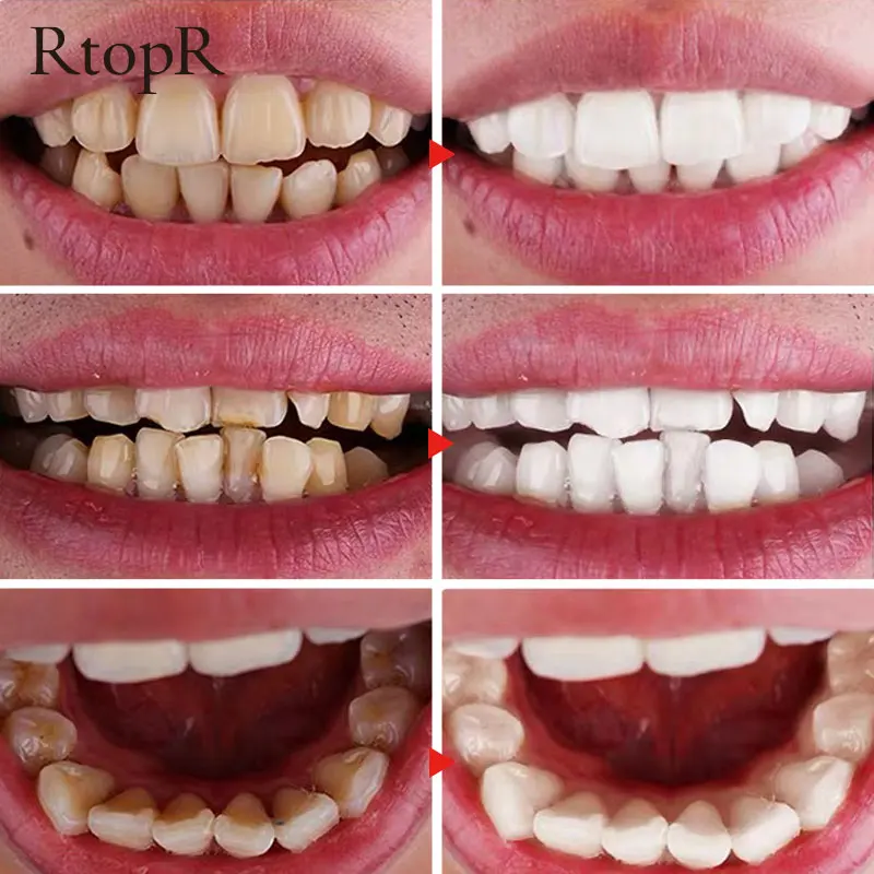 RtopR Teeth Cleaning Mousse Tooth Powder Teeth Whitening Tartar Cleaning Plaque Removing Toothpaste Fresh Breath Oral Cleansing