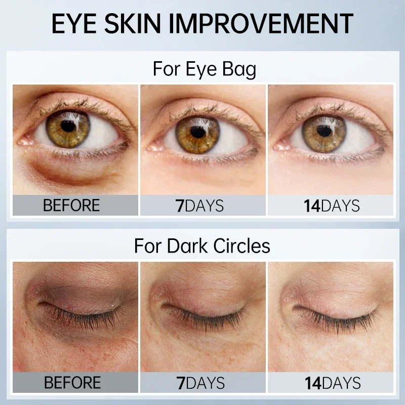 New Eye Dark Circles Remover Cream Repair Skin Barrier Fade Eyes Bag Puffiness Fine Lines Anti-aging Wrinkles Lift Firm Eye Care