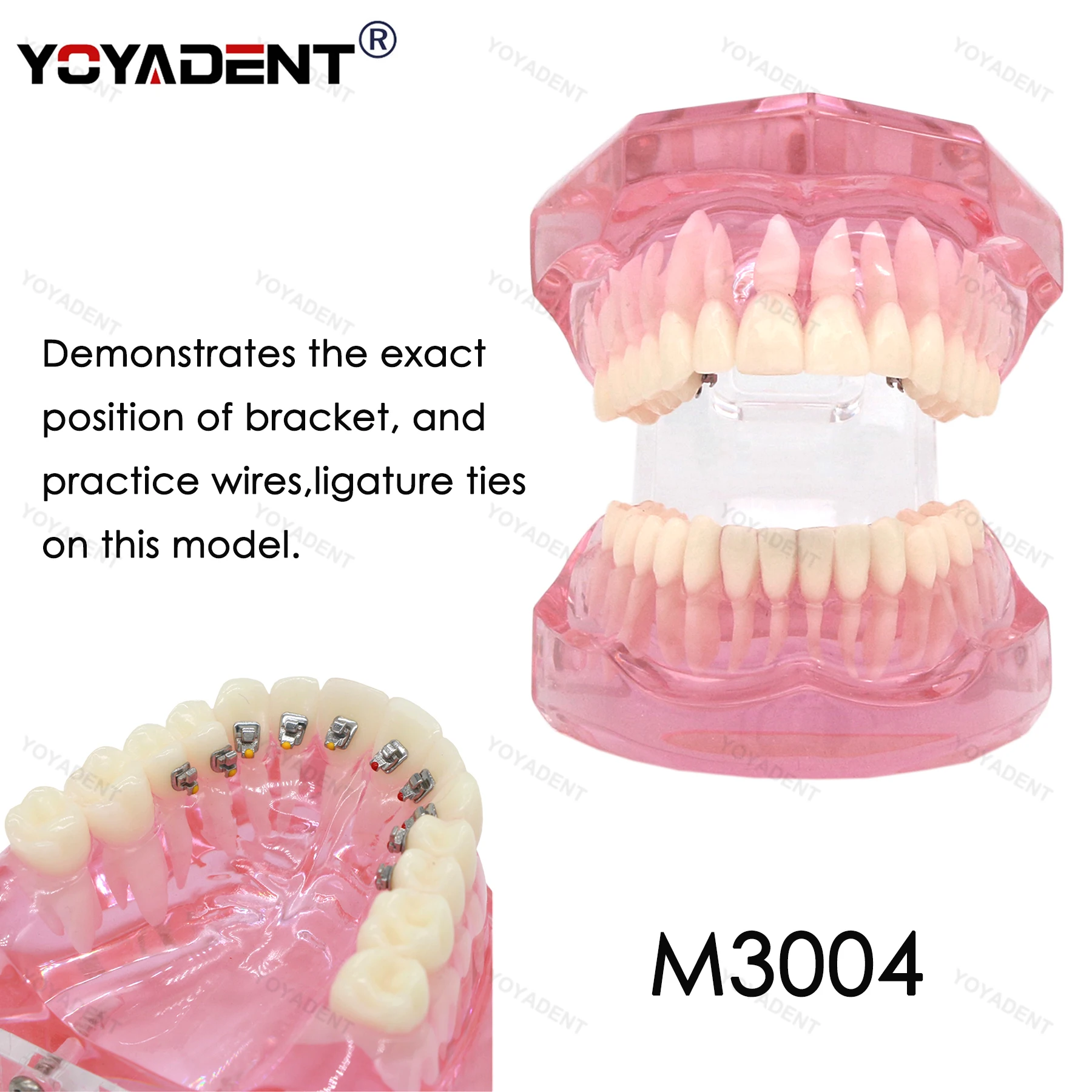 

Dental Orthodontic Teeth Model With Lingual Bracke Invisible Orthodontics For Orthodontic Correction Teaching Dentist Demo