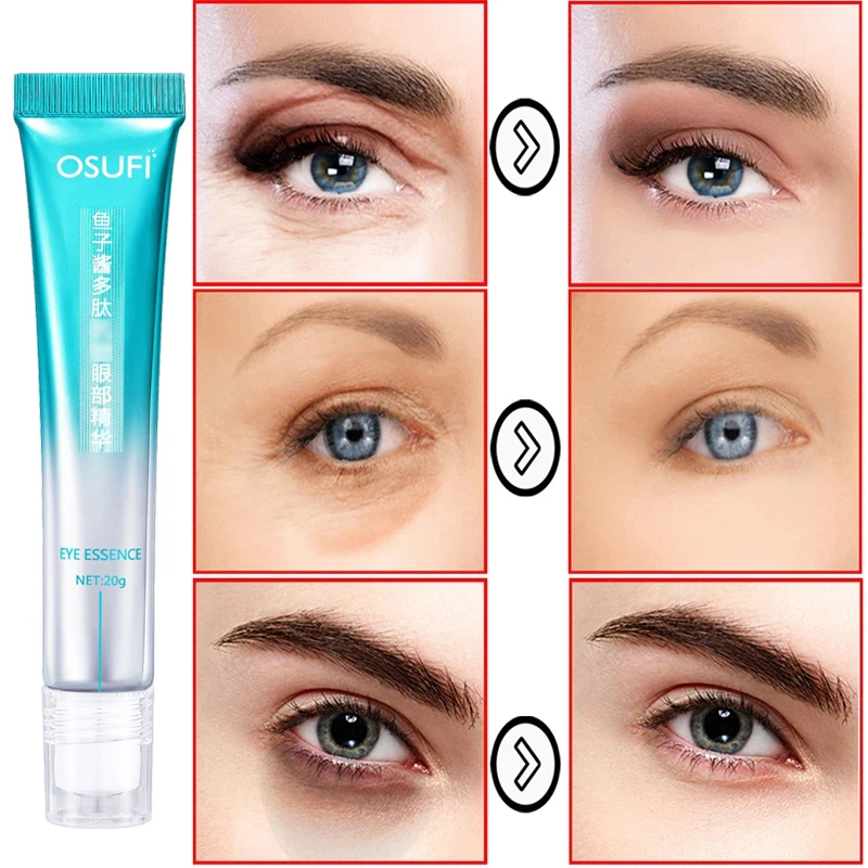 New Anti Wrinkle Eye Essence Reduces Eye Wrinkles Removes Eye Bags Dark Circles Moisturizes Skin Around Eyes Massage Eye Cream