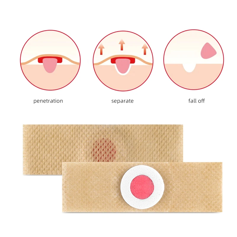 6PCS Foot Care Sticker Medical Patch Corn Removal Pads Curative Patches Calluses Remove Callosity Detox Summer Foot Care Tools