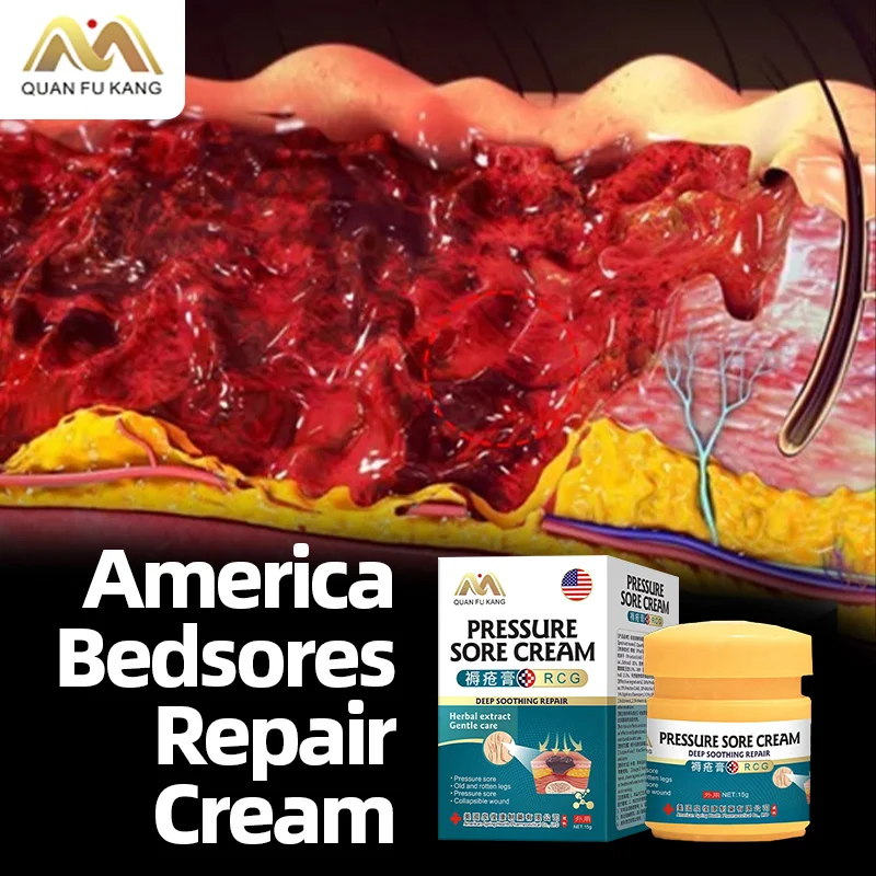 

Bedsores Cream Remove Rot Myogenic Skin Pressure Ulcer Decubitus Anti Bed Sore Wound Healing Treatment American Formula Medicine