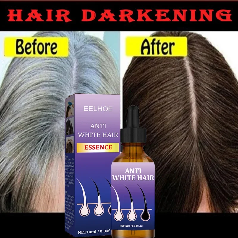 Black hair growth from the source,anti-white hair growth liquid roots grow black essence care grows out the growth of white