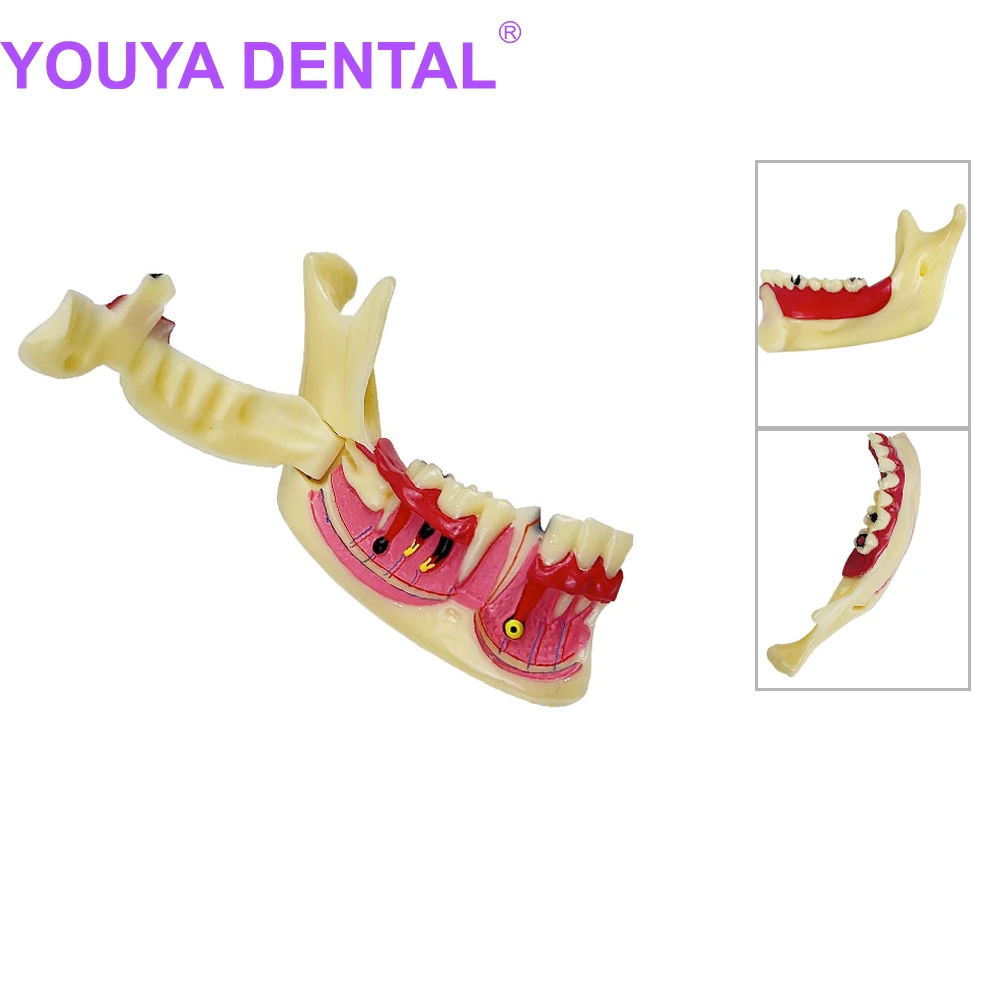 

Dental Endodontic Treatment Model Mandible Tissue Anatomical Model Anatomy of Gums Dentistry Study Dental Materials Dentistry Pr