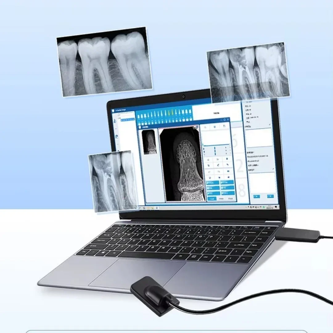 

VV Dental for Clinics Intra-Oral Examination X-ray Sensor Equitment Portable High-Frequency Digital Ray Sensor