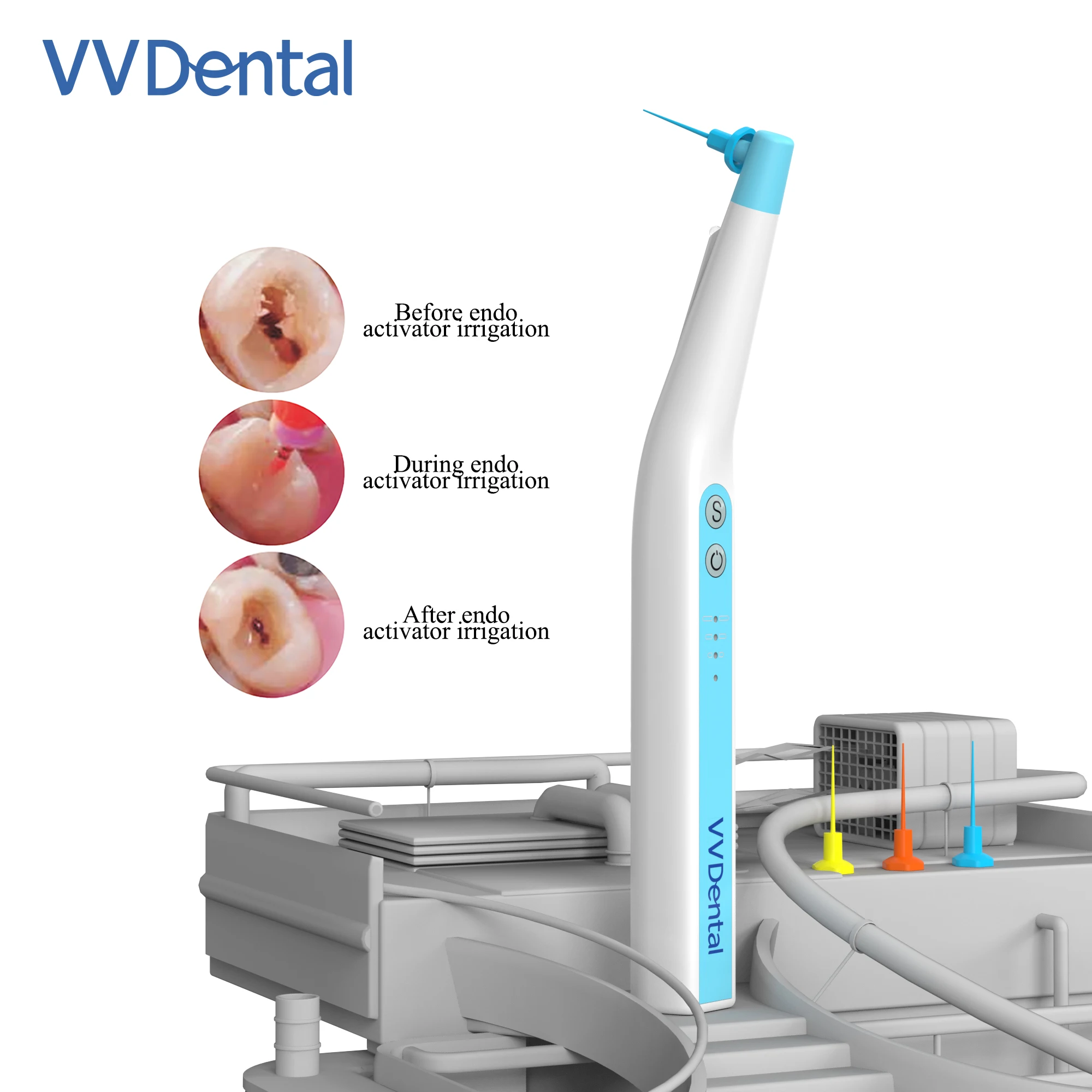 VVDental RW-3 Wireless Ultrasonic Activator LED Light High Vibration Frequency Root Canal Filling Washing Dental Tool