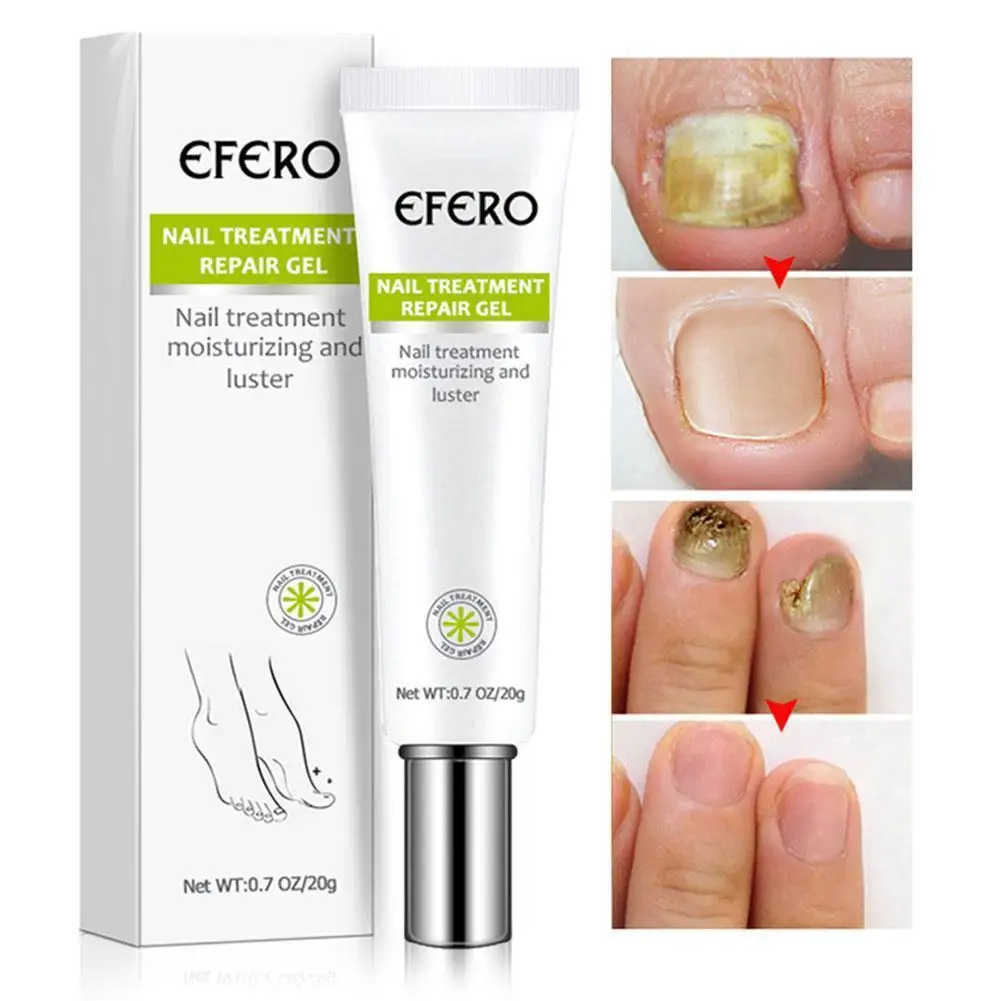 20g Nail Treatment Serum Repair Essence Toe Finger Nourishing Brighten Nail Serum Nails Products Foot Finger Care