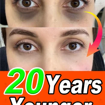 ᴵⁿˢᵗᵃⁿᵗˡʸ ʳᵉᵐᵒᵛᵉ ᵉʸᵉ ᵇᵃᵍˢ⸴ ʳᵉᵈᵘᶜᵉ ᶠⁱⁿᵉ ˡⁱⁿᵉˢ⸴ ᵗⁱᵍʰᵗᵉⁿ ˢᵏⁱⁿ⸴ ᶠⁱᵍʰᵗ ᵈᵃʳᵏ ᶜⁱʳᶜˡᵉˢ⸴ ᵃⁿᵈ ᵇʳⁱᵍʰᵗᵉⁿ ᵉʸᵉˢ