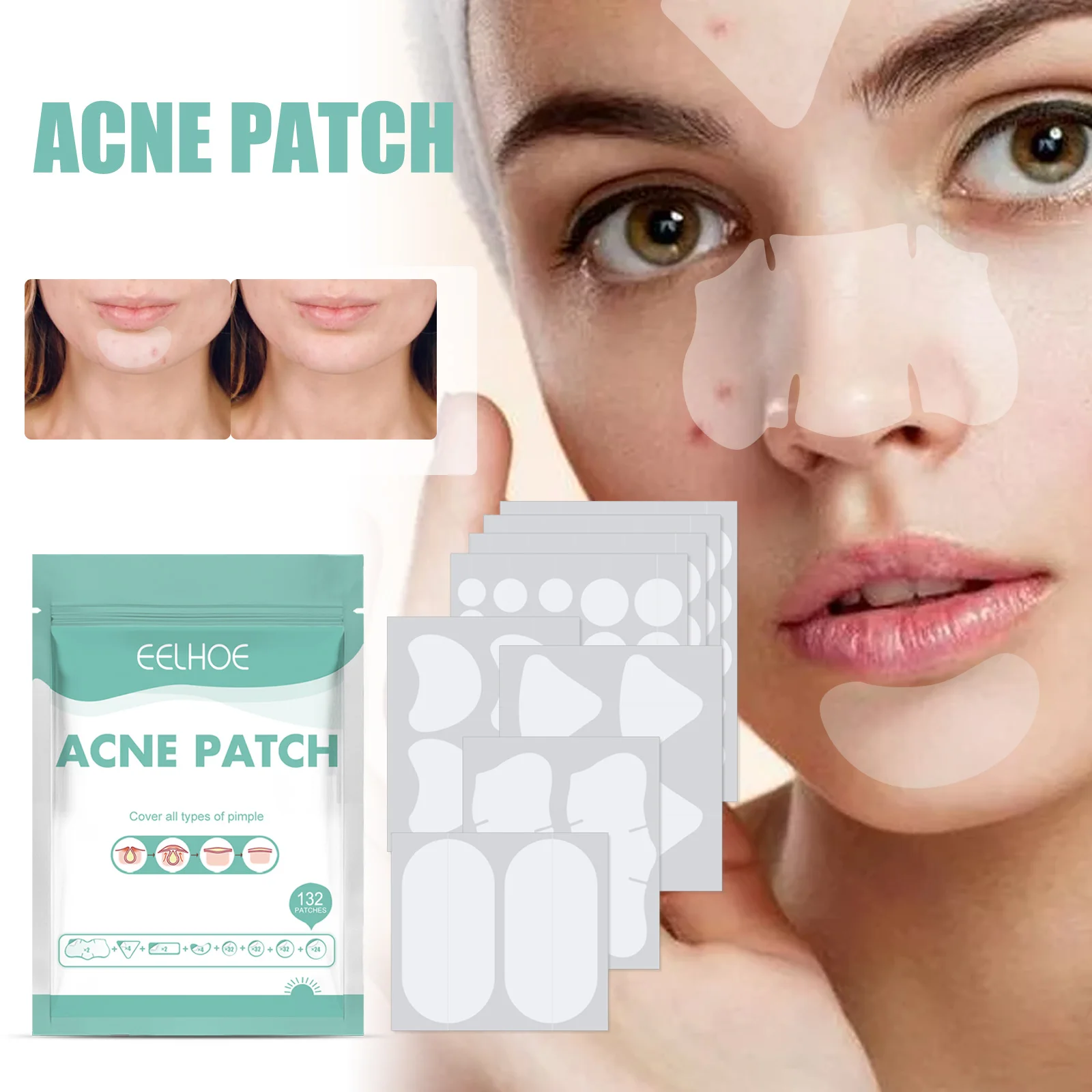 Parches suaves para el acné, tratamiento hidrocoloide calmante para imperfecciones, parches para espinillas respetuosos con la piel para pieles sensibles