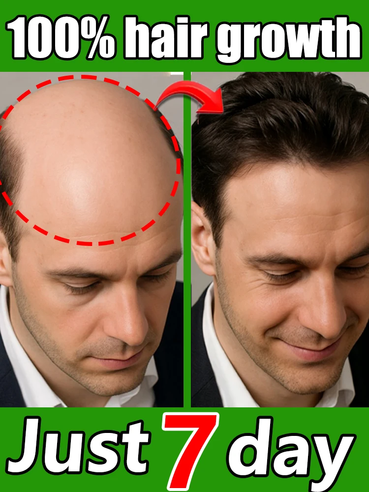 

Hᴀɪʀ sᴘʀᴀʏ,ᴏ̨ᴜɪᴄᴋʟʏ ᴘᴇɴᴇᴛʀᴀᴛᴇs ʜᴀɪʀ ғᴏʟʟɪᴄʟᴇs awakens dormant hair follicles.