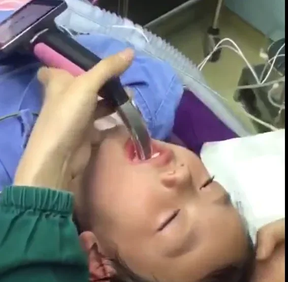 Best Handheld Video Laryngoscope With Anti-fog Function For Pediatric Neonatal Adult