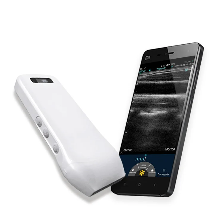 

Medical ultrasound instruments Handheld 128 Elements Wireless Wifi Linear Ultrasound Probe