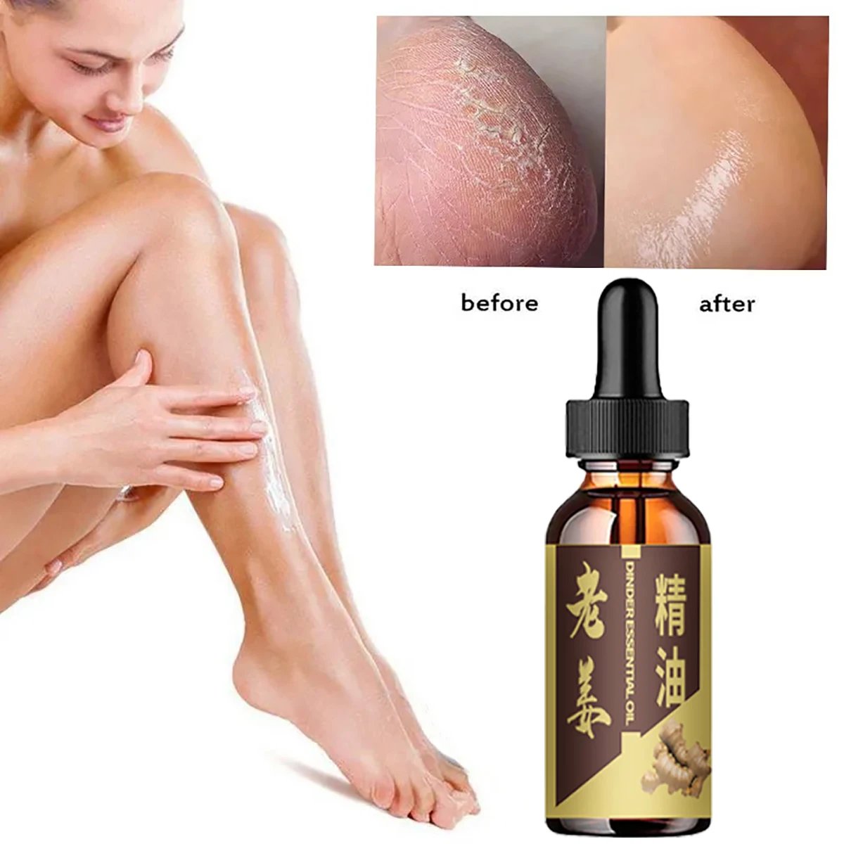 

Ginger essential oil moisturizes and prevents cracking