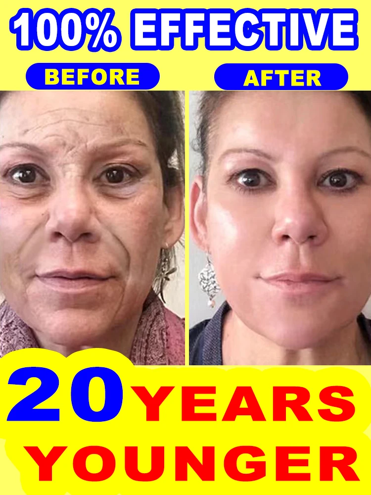 

20 years younger, no fine lines