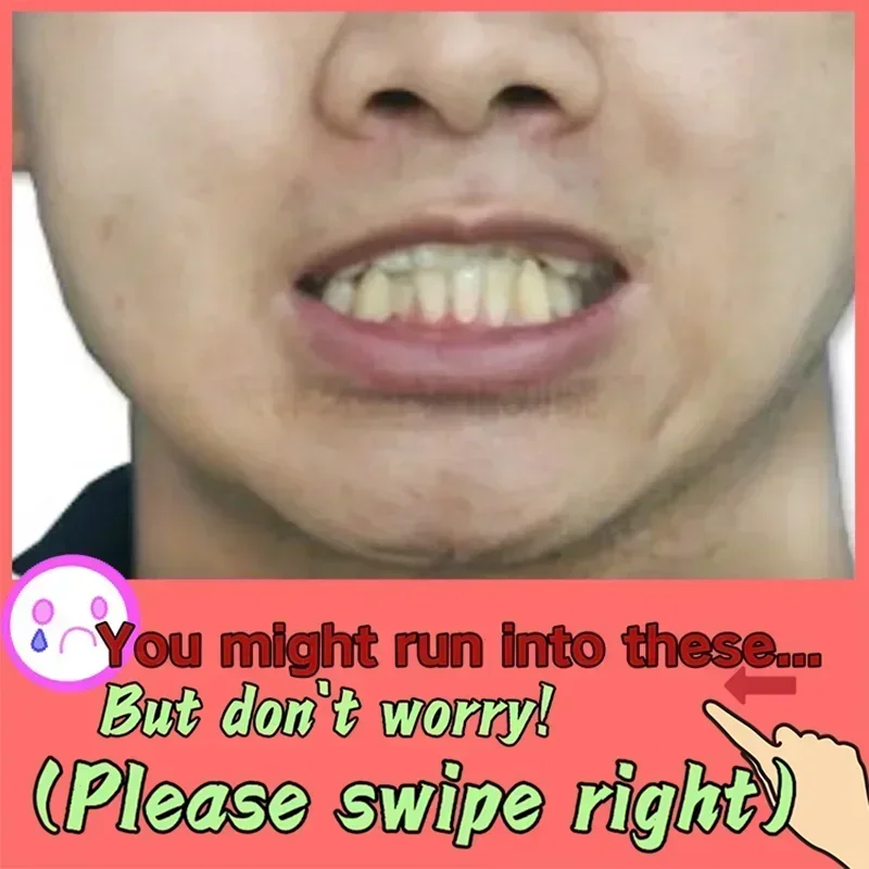 3R إصلاح سريع للتسوس إزالة البقع البلاكية تسوس تبييض اصفرار إصلاح تبييض الأسنان #3