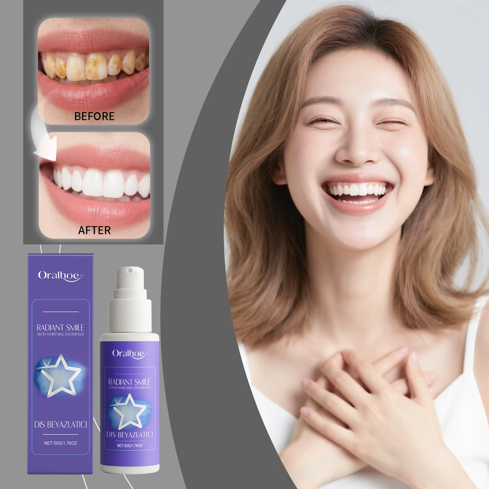 Teeth Whitening Or Bleaching - ORALHOE 50g Purple Teeth Whitening Toothpaste