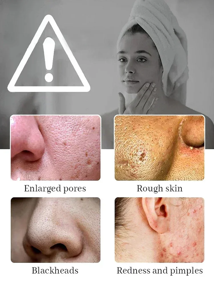 Pore Removal Cleans Nose Blackheads Skin Firming Moisturizing Facial Essence Skin Care