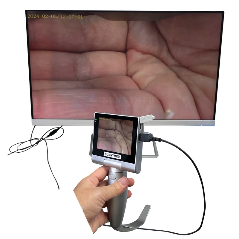 

SY-P020A Medical Anesthesia Video Laryngoscope with Reusable or Disposable Blade Video Larynogoscope for Intubation