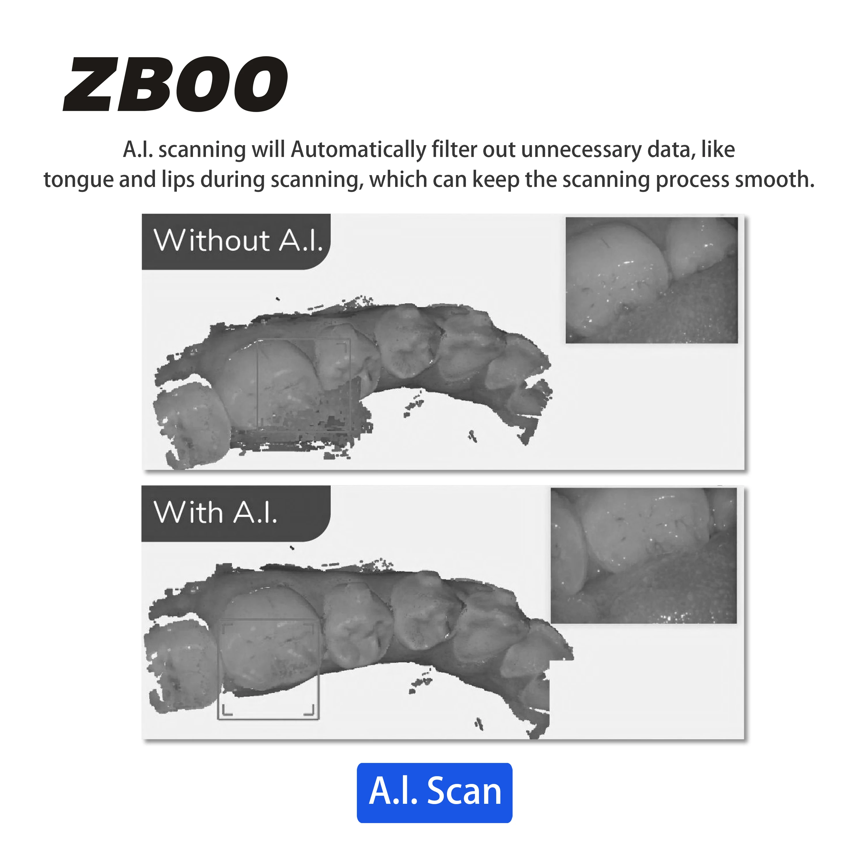 Tandheelkundige intraorale scanner 3D voor tandheelkundige restauratie Orthodontie Kroonimplantaat Tandheelkundige apparatuur