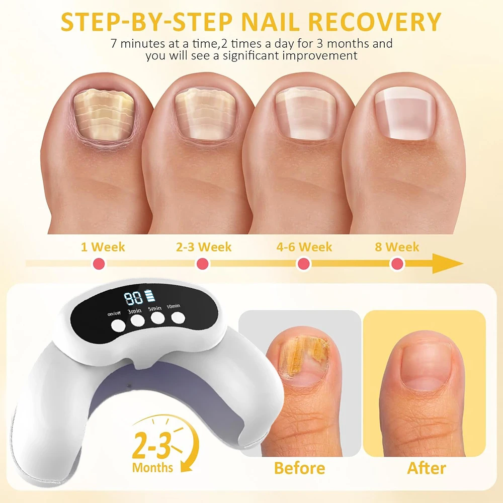 Thumbnail 4 - #51 Nail Care List of Top Picks