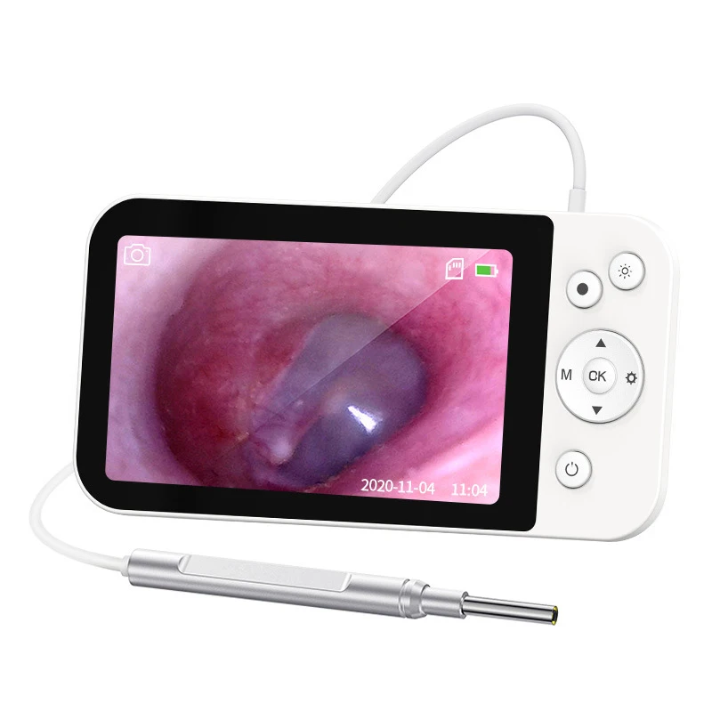 Portable Professional Veterinary Ear Wax Removal Endoscope Otoscope Earwax Endoscope Usb Otoscope Camera- For Vet