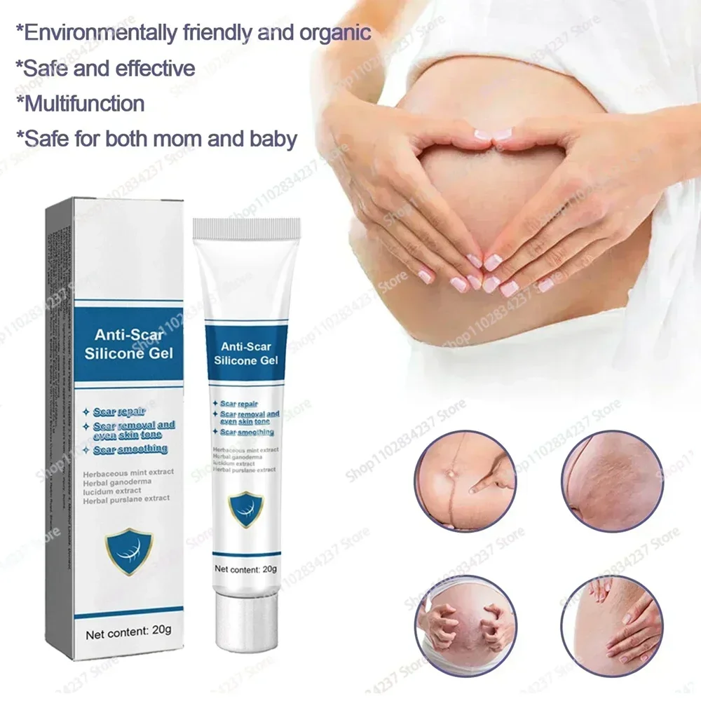 

Stretch Marks Repair Skin Care For Maternity Remover Anti-Wrinkle Slackline For Pregnant Body Care