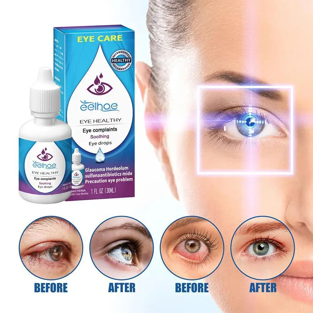 30ml Eye Drops Eye Protection Relieve Fatigue Dry Treat Styes Prevention Diseases Eyes Eye Of Ointment Red Eye R5P1