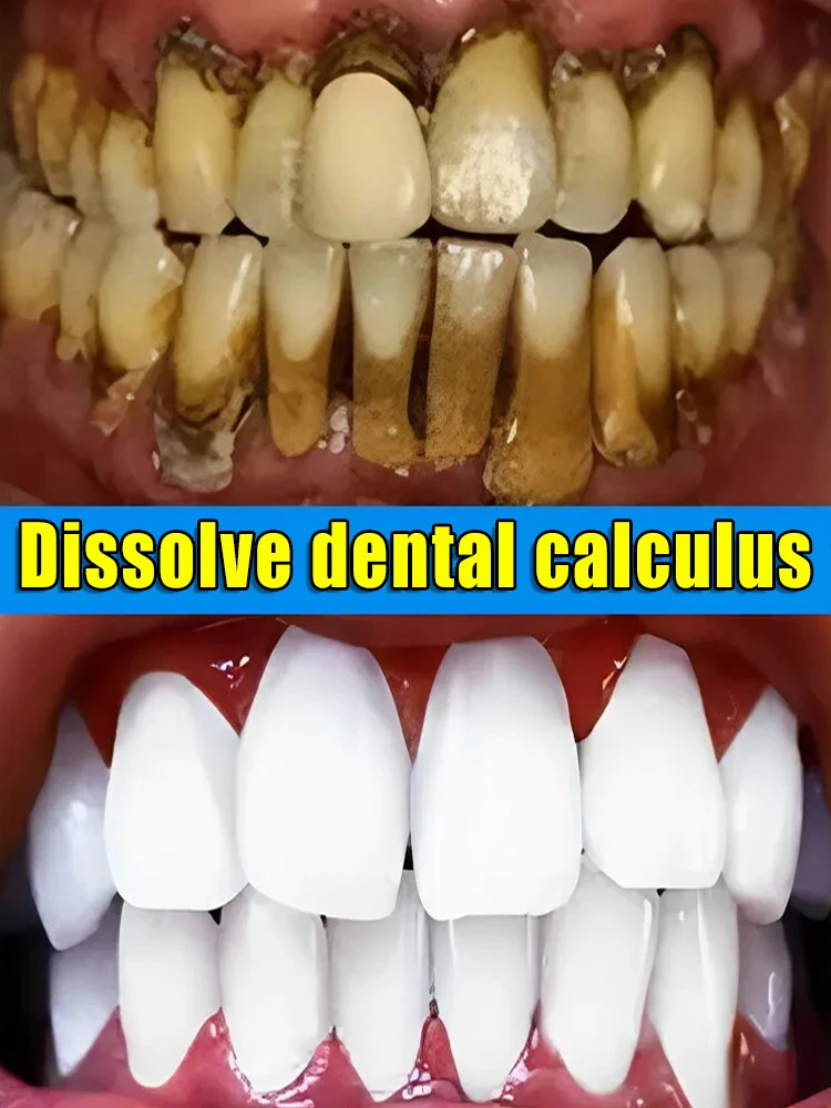 فرشاة واحدة وكل ذهب