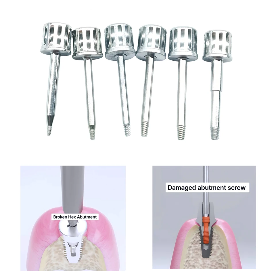 Dental Implant Fixture Saver Broken Screw Extractor Tool Abutment Thread Galling Repair Tap 1.0-2.0mm Dentistry Supplies