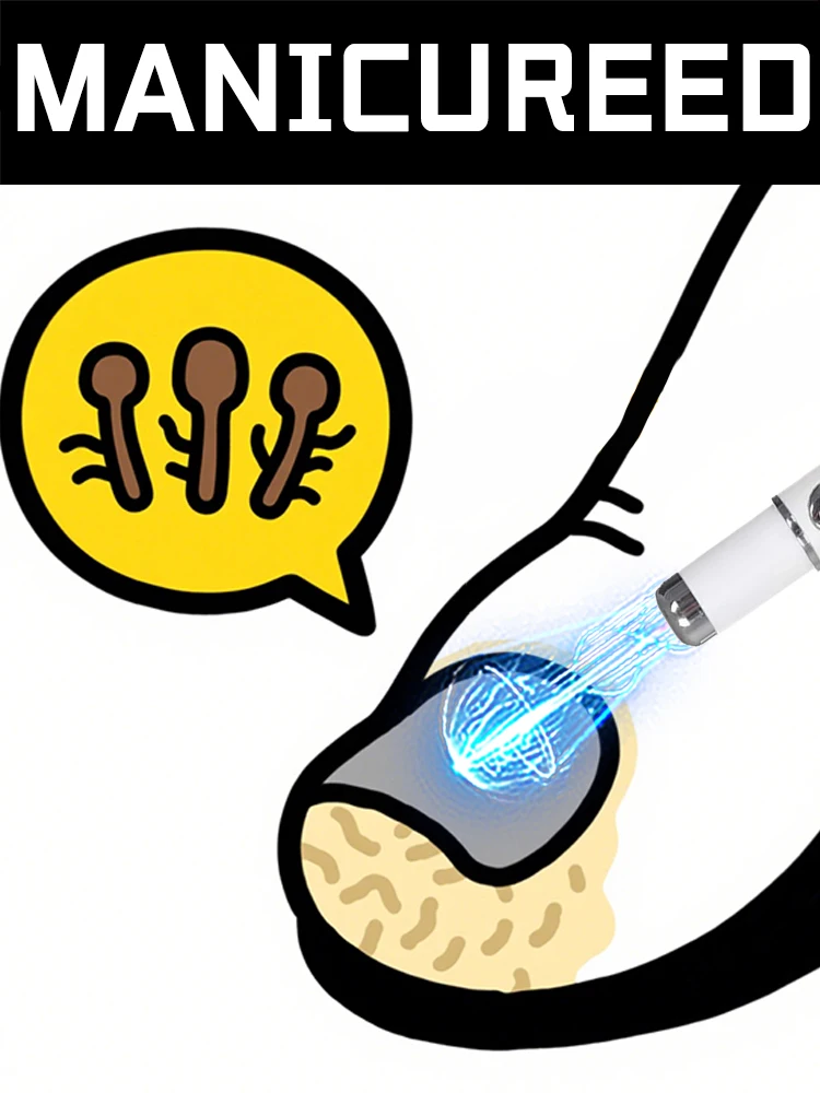 

Лазерная ручка для маникюра 5-го поколения Champagne Nail. Поможет вам попрощаться с ᵒⁿʸᶜʰᵒᵐʸᶜᵒˢⁱˢ· ᴱᶠᶠᵉᶜᵗⁱᵛᵉ ⁿᵃⁱ*l ᶠᵘⁿ"gᵘˢ