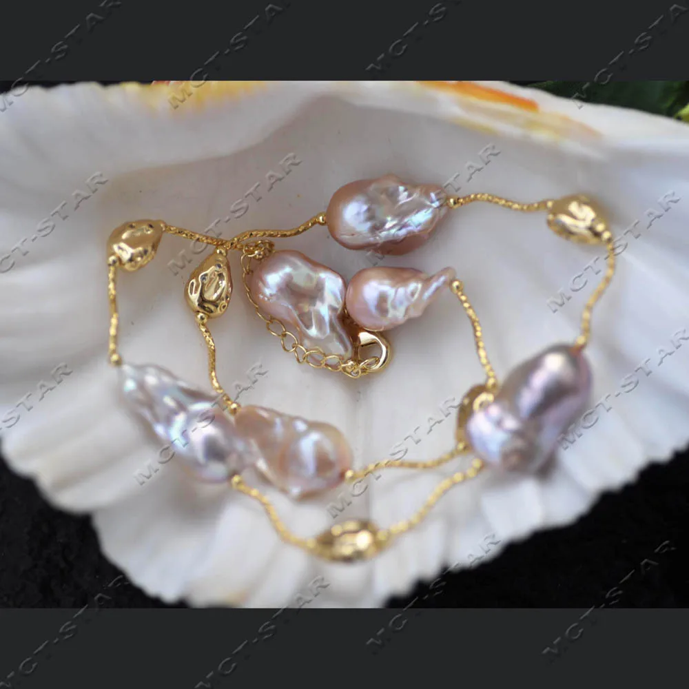 Mtc·Star 22" 25Mm L… - image