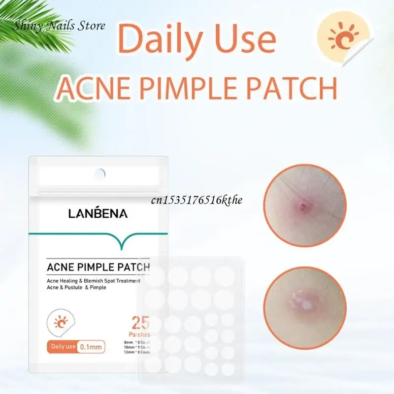 Acne Pimple Patches Acne Removing Invisible Sticker Remover Acne Mask Patches Day/Night Use Skin Care Dropship