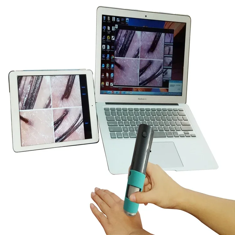 Portable 600x Wifi Digital Microscope With Wireless Hair Detector And analyzer