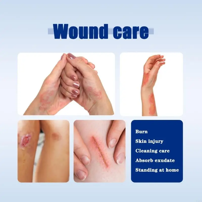 55KD Hemostatic Dressing Gauze Burn and Scald Accessories Gauze Wound Packing Bandages First Aids Hemostatic Gauze