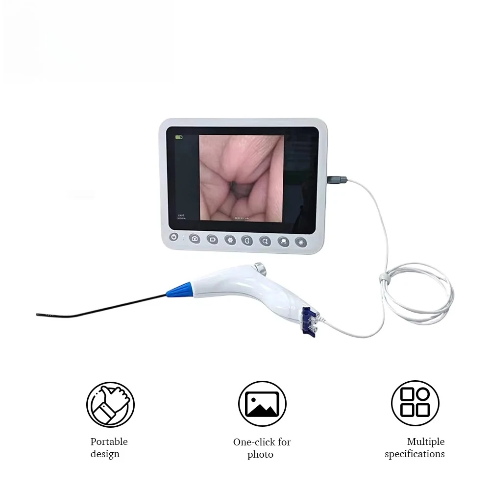 USB Camera Sensor 160K Resolution 30FPS for Hysteroscopy