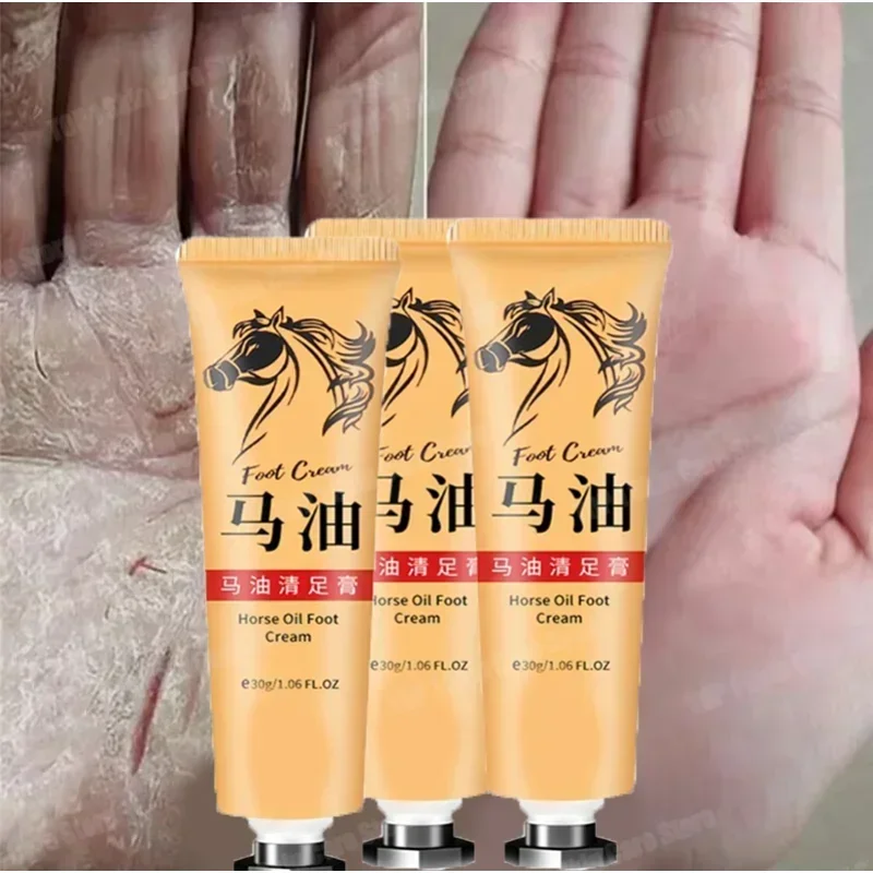 Horse Oil Skin Cream Anti-cracking Ointment Prevents Dry Skin Moisturizes Protects Fingers Feet and Skin Care Products