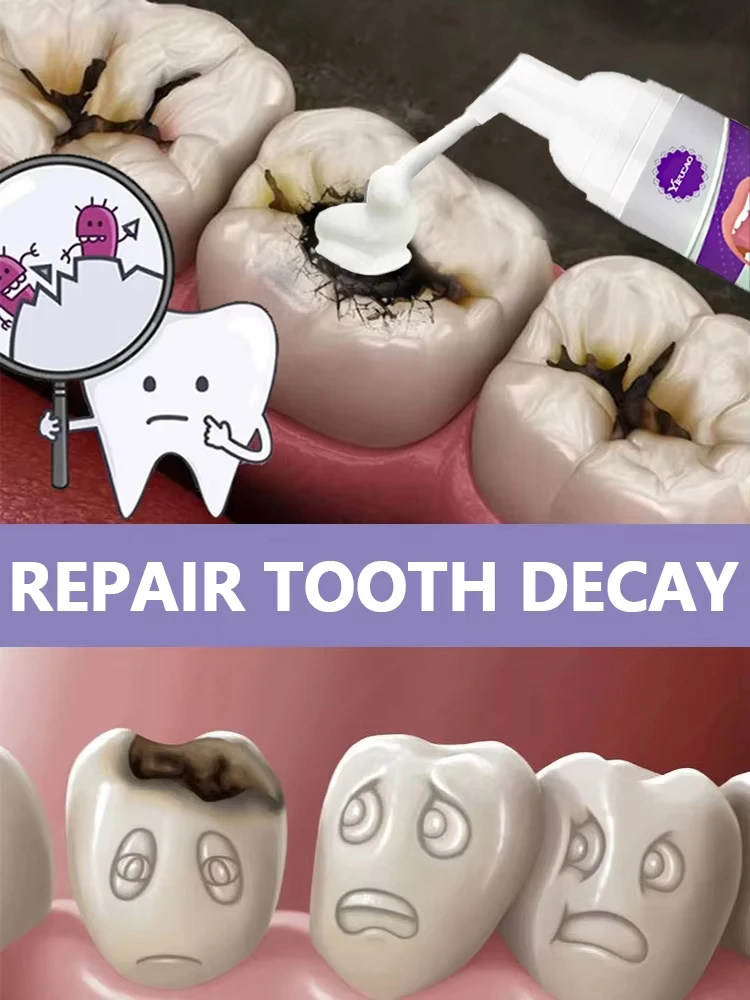 Almost 100% cavities can be repair by this product