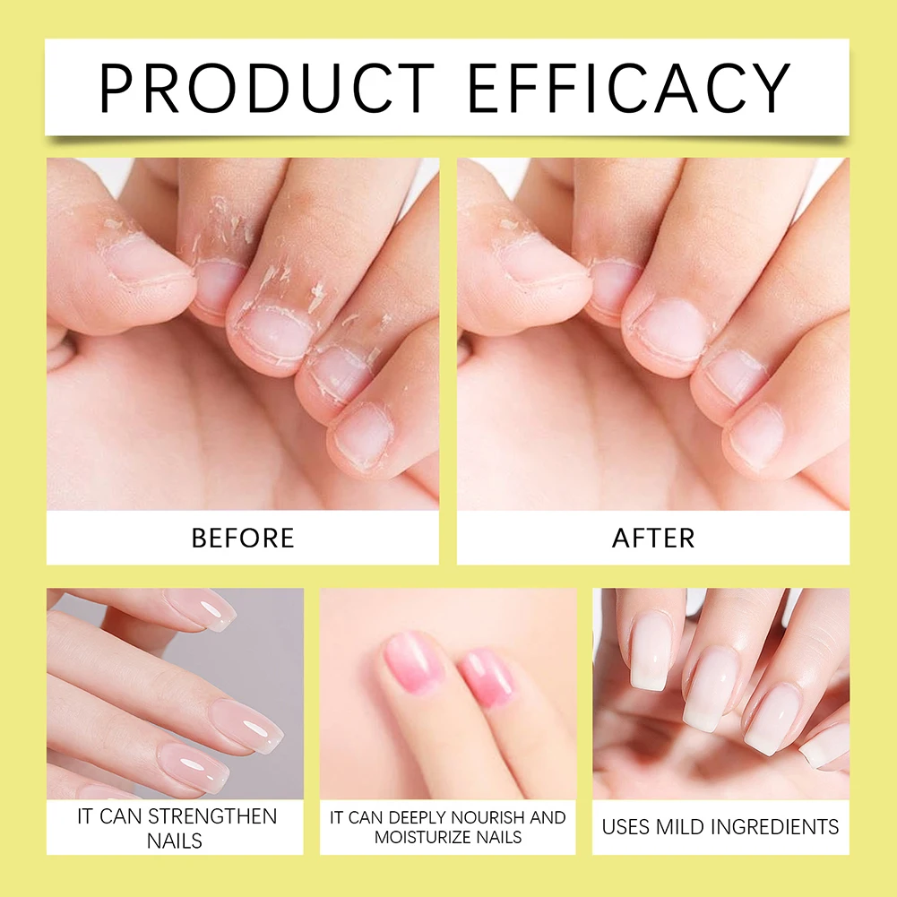 2G若返り爪成長キューティクルオイルナチュラル穏やかな非灌漑クイック吸収爪の爪のケア用品