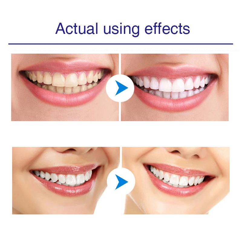 Teeth Brighten Whitening Essence Care Reduces Yellowing Stains Color Correction Whitening Incremental Oral Cleaning Fresh Breath