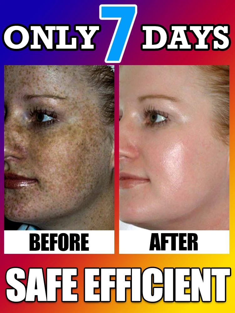 

Spot - removal essence gently improves spots, quickly brightens skin tone, improves dullness