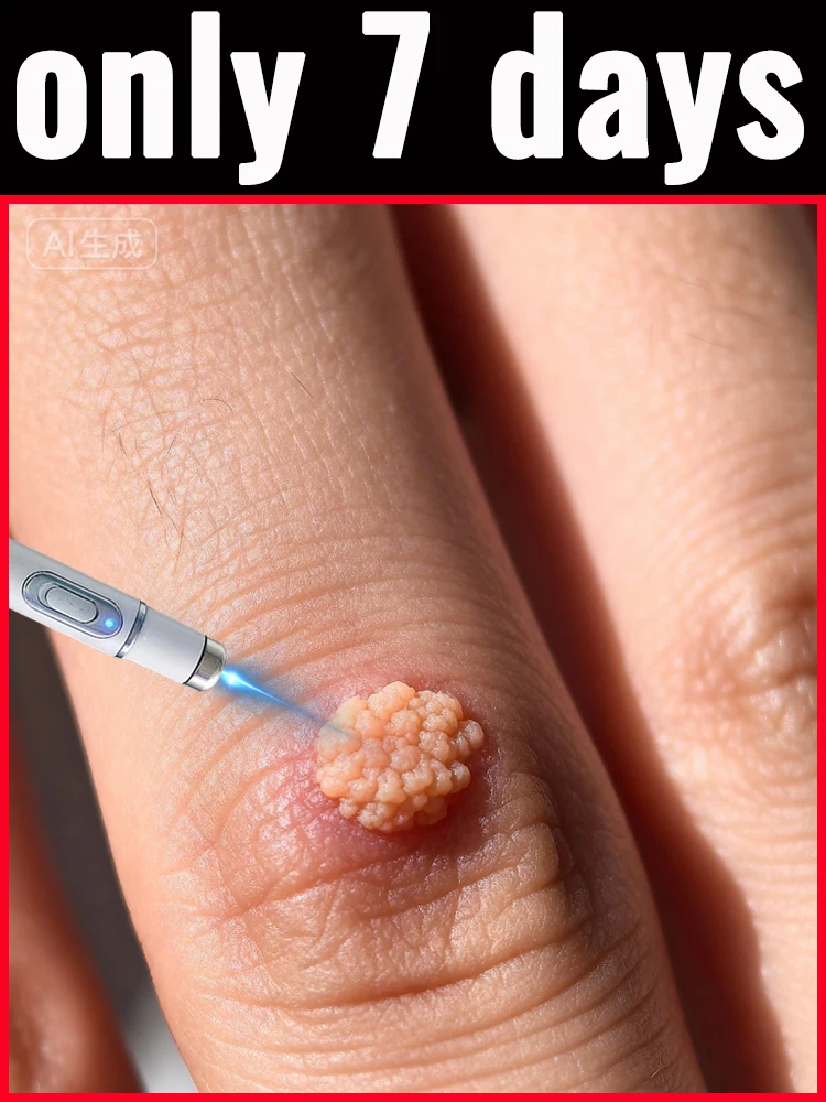 ᵍᵉⁿᵉʳᵃᵗⁱᵒⁿ ᵘᵖᵍʳᵃᵈᵉᵈ wᵃʳᵗ ⸴ ʳᵉpᵃⁱʳ wᵃʳᵗˢ ʳᵒoᵗ ⸴ ᑫᵘⁱᶜᵏˡʸ 2nd