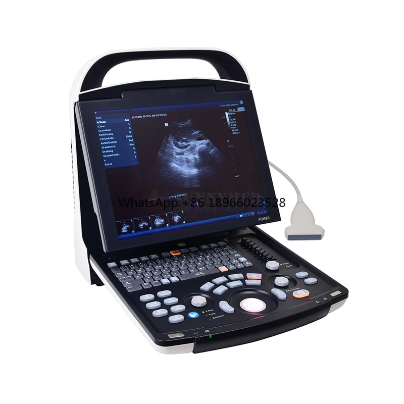 Portable Full digital ultrasound device Original Mindray DP-30 BW Mindray DP 30 ultrasound machine