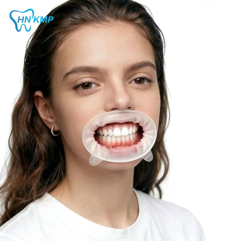 3D Soft Dental Mouth Opener O Shape Lip Cheek Retractor Food Safe Rubber Oral Expander for Dentist Office Home Oral Care Use