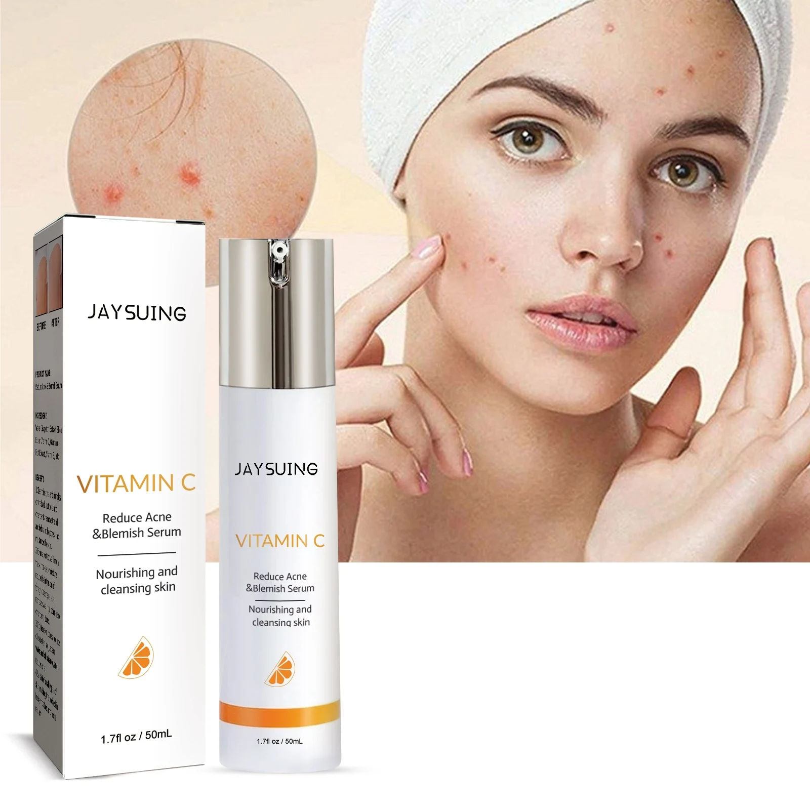 

Acne-Removing Essence Body Facial Pimples Removal Oil-Control Fade Fine Lines Moisturize Smooth Skin Vitamin E Brighten Lotion