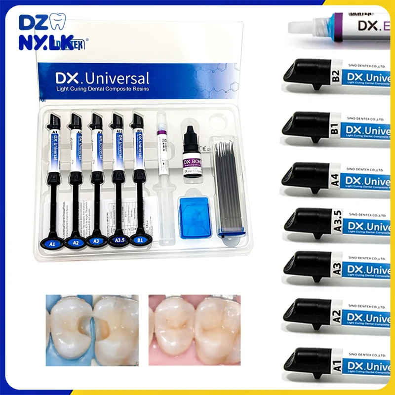 

Dental Curing Light Universal Composite Resin/Light Cure Bonding Adhesive/Etch Gel Kit Dentistry Aesthetic Restoration Materials