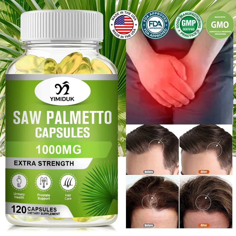 

Saw Palmetto Supplement - Promotes Men's Prostate Health - Blocks DHT and Prevents Hair Loss Gluten Free Non-GMO 120 Capsules