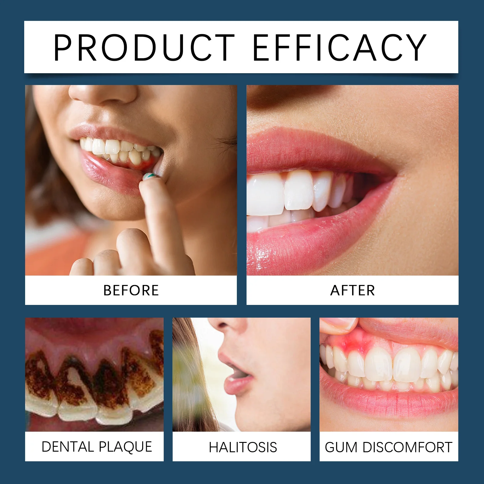 Żel Rapid Repair Gums skutecznie łagodzi alergię na zęby, zapobiega przeziębieniom, czyszczy zęby, pasta do zębów, serum łagodzące uszkodzenia zębów.