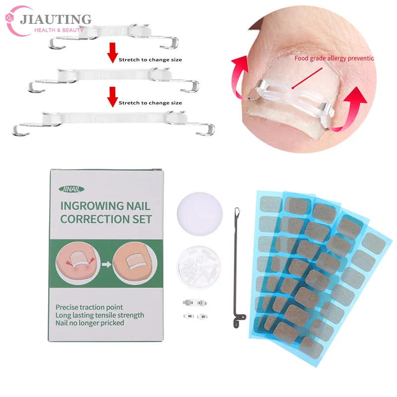 

1/2Set Stainless Ingrown Toenail Corrector Tools Pedicure Recover Embed Toenail Treatment Professional Foot Care Correction Tool