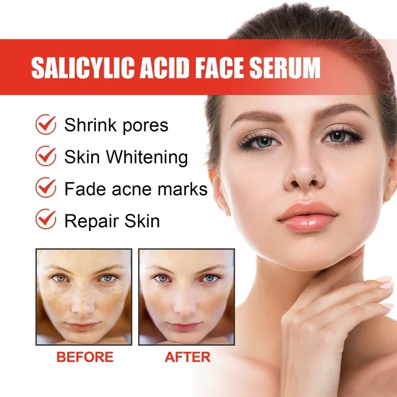 Niacinamide Facial Serum Salicylic Acid Moisturizing Fade Spots And Acne Marks Shrink Pores Skin Care Products 2024